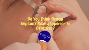 Dental Implants